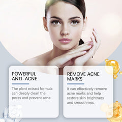 Acne Soothing Hydrating Facial Care Serum Solution