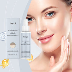 Acne Soothing Hydrating Facial Care Serum Solution